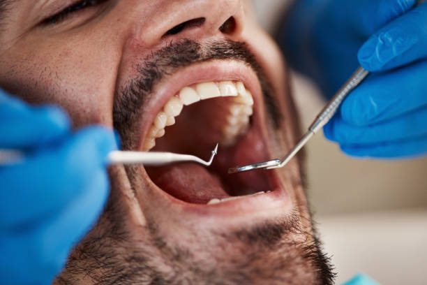 Best Emergency Dental Care for Trauma or Injury in Dollar Bay, MI